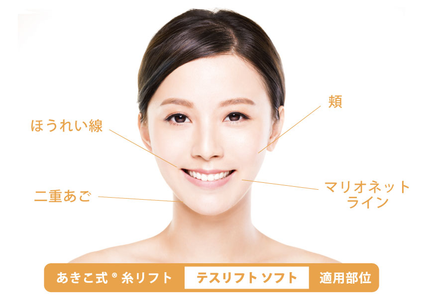 あきこ式®糸リフト